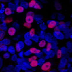 Human Islet-1 Antibody, R D Systems 25&mu;g; Unlabeled:Antibodies, Polyclonal