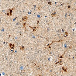 Human Isocitrate Dehydrogenase 1/IDH1 Antibody, R D Systems 25&mu;g; Unlabeled:Antikörper