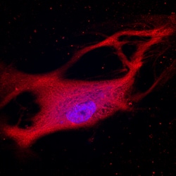 Human Jagged 2 Antibody, R D Systems 100&mu;g; Unlabeled:Antibodies, Polyclonal