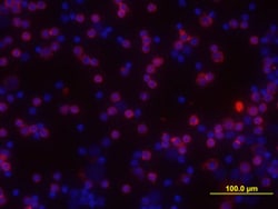 Mouse/Rat Jak1 Antibody, R D Systems 25&mu;g; Unlabeled:Antibodies, Polyclonal