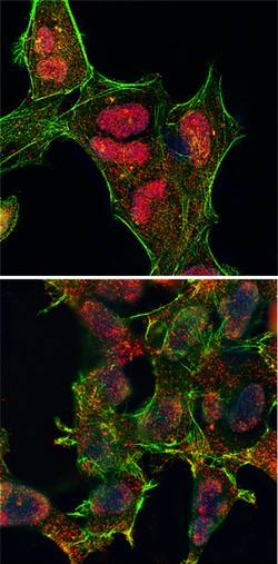 Human/Mouse/Rat Phospho-JNK (T183/Y185) Antibody, R D Systems 100 ug; Unconjugated:Antibodies,