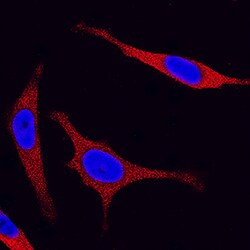 Human/Mouse/Rat JNK2 Antibody, R D Systems 25&mu;g; Unlabeled:Antibodies,