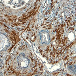 Human/Mouse/Rat JNK Pan Specific Antibody, R D Systems 25&mu;g; Unlabeled:Antibodies,