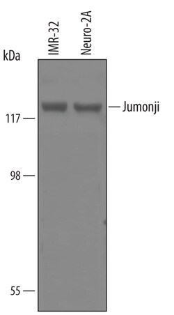 Jumonji/JARID2 Sheep anti-Human, Mouse, Polyclonal, R D Systems 25&mu;g;