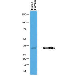 Human Kallikrein 3/PSA Antibody, R D Systems 100&mu;g; Unlabeled:Antibodies,