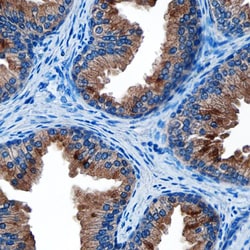 Human Kallikrein 3/PSA Antibody, R D Systems:Antibodies:Primary Antibodies