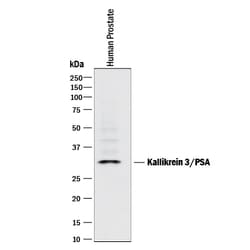 Human Kallikrein 3/PSA Antibody, R D Systems:Antibodies:Primary Antibodies