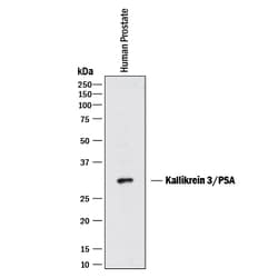 Human Kallikrein 3/PSA Antibody, R D Systems:Antibodies:Primary Antibodies