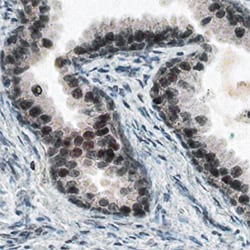 Human Kallikrein 4/Prostase/EMSP1 Antibody, R D Systems 25&mu;g; Unlabeled:Antibodies,