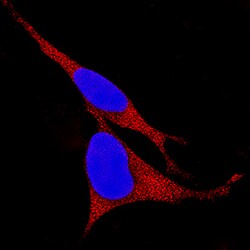 Human Kallikrein 8/Neuropsin Antibody, R D Systems 500ug; Unlabeled:Antibodies,