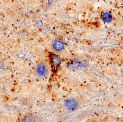 Human Katanin p60 Antibody, R D Systems 25&mu;g; Unlabeled:Antibodies,