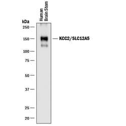 Human KCC2/SLC12A5 Antibody, R D Systems 100ug; Unlabeled:Antibodies, Monoclonal