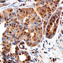 Human Ki67/MKI67 Antibody, R D Systems 100&mu;g; Unlabeled:Antibodies,