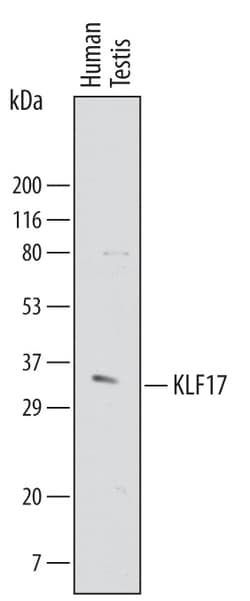 Human KLF17 Antibody, R D Systems 25&mu;g; Unlabeled:Antibodies, Polyclonal