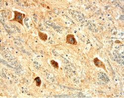 Human KOR Antibody, R D Systems 25&mu;g; Unlabeled:Antibodies, Monoclonal
