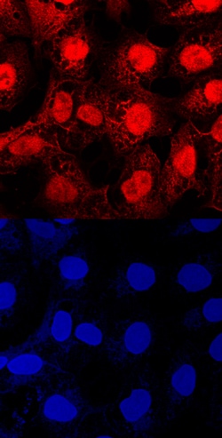 Human Importin alpha 2/KPNA2 Antibody, R D Systems 100&mu;g; Unlabeled:Antibodies,