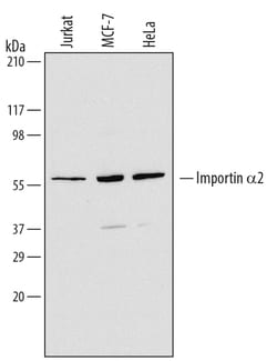 Human Importin alpha 2/KPNA2 Antibody, R D Systems 100&mu;g; Unlabeled:Antibodies,