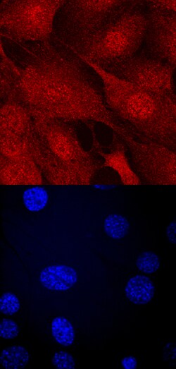 Human Importin alpha 2/KPNA2 Antibody, R D Systems 100ug; Unlabeled:Antibodies,