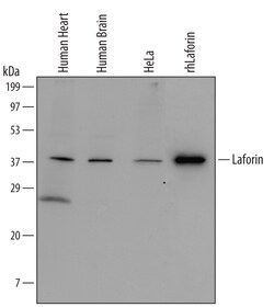 Human Laforin/EPM2A Antibody, R D Systems 25 &mu;g | Buy Online | R&D Systems | Fisher Scientific