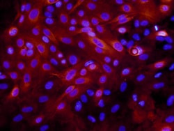 Human Laminin alpha 3/Laminin-5 Antibody, R D Systems 25&mu;g; Unlabeled:Antibodies,