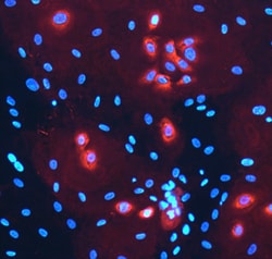 Human Laminin alpha 3/Laminin-5 Antibody, R D Systems 100ug; Unlabeled:Antibodies,