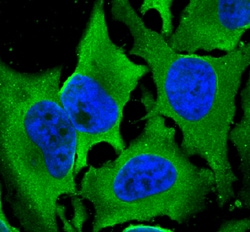 Human/Rat/Chicken Laminin S Antibody, R D Systems 100ug; Unlabeled:Antibodies,