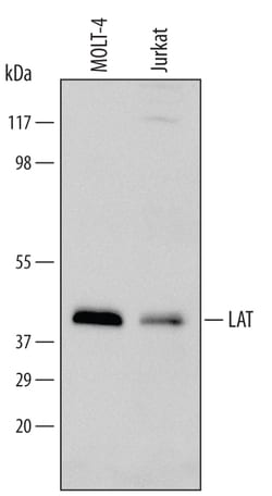 Human LAT Antibody, R D Systems 100&mu;g; Unlabeled:Antibodies, Polyclonal