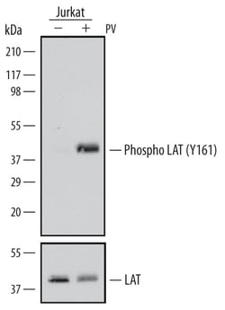 Human Phospho-LAT (Y161) Antibody, R D Systems 100ug; Unlabeled:Antibodies,