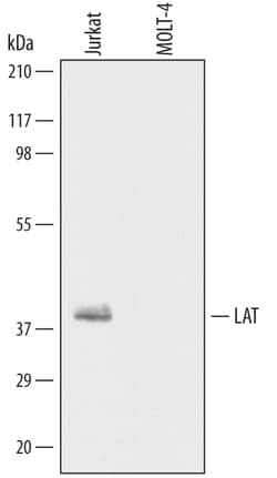 Human LAT Antibody, R D Systems 100ug; Unlabeled:Antibodies, Monoclonal
