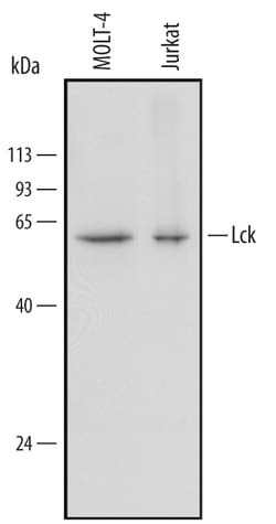 Human Lck Antibody, R D Systems 100&mu;g; Unlabeled:Antibodies, Polyclonal