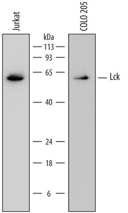 Human Lck Antibody, R D Systems 100ug; Unlabeled:Antibodies, Monoclonal