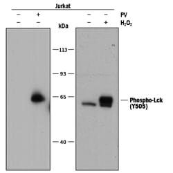 Human Phospho-Lck (Y505) Antibody, R D Systems 100 &mu;g | Buy Online | R&D Systems | Fisher Scientific