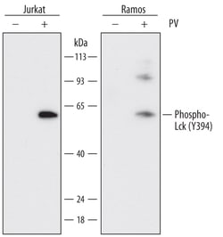 Human Phospho-Lck (Y394) Antibody, R D Systems 25&mu;g; Unlabeled:Antibodies,
