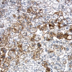 Human LDLR Antibody, R D Systems 25&mu;g; Unlabeled:Antibodies, Polyclonal