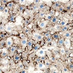 Mouse LDLR Antibody, R D Systems 100&mu;g; Unlabeled:Antibodies, Polyclonal