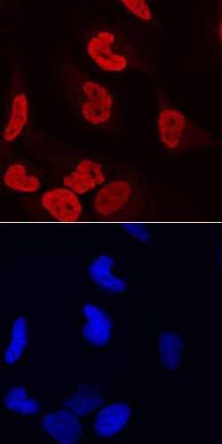 Human LEDGF Antibody, R D Systems 25&mu;g; Unlabeled:Antibodies, Polyclonal