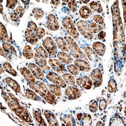 Human Leptin/OB Antibody, R D Systems 100&mu;g; Unlabeled:Antibodies, Polyclonal
