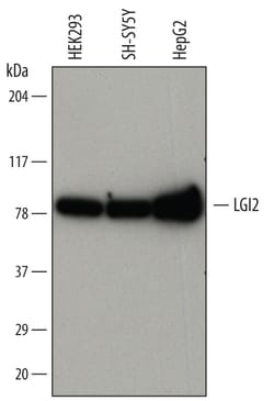 Human LGI2 Antibody, R D Systems 25&mu;g; Unlabeled:Antibodies, Monoclonal