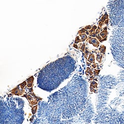 Mouse LIF Antibody, R D Systems 1mg; Unlabeled:Antibodies, Polyclonal