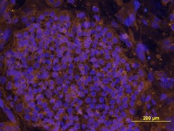 Human LIN-41 Antibody, R D Systems 100&mu;g; Unlabeled:Antibodies, Polyclonal
