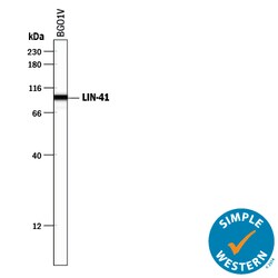 Human LIN-41 Antibody, R D Systems 100&mu;g; Unlabeled:Antibodies, Polyclonal