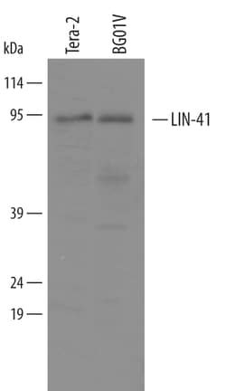 Human LIN-41 Antibody, R D Systems 100&mu;g; Unlabeled:Antibodies, Polyclonal