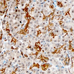 Human Lipocalin-2/NGAL Antibody, R D Systems 500&mu;g; Unlabeled:Antibodies,