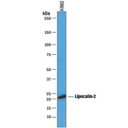 Human Lipocalin-2/NGAL Antibody, R D Systems 500&mu;g; Unlabeled:Antibodies,