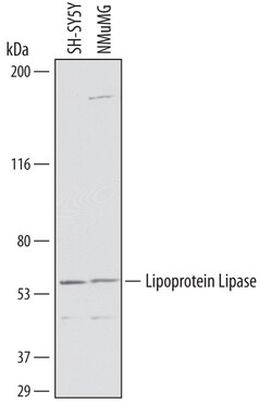 Human/Mouse Lipoprotein Lipase/LPL Antibody, R D Systems 100&mu;g; Unlabeled:Antibodies,