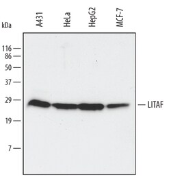 Human LITAF Antibody, R D Systems 100&mu;g; Unlabeled:Antibodies, Polyclonal
