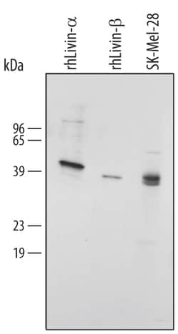 Human Livin Antibody, R D Systems 100&mu;g; Unlabeled:Antibodies, Polyclonal