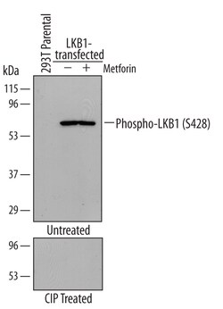 Human Phospho-LKB1/STK11 (S428) Antibody, R D Systems 100&mu;g; Unlabeled:Antibodies,