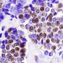 Human LKB1/STK11 Antibody, R D Systems 100ug; Unlabeled:Antibodies, Polyclonal