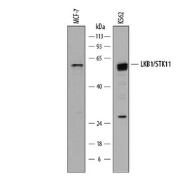 Human LKB1/STK11 Antibody, R D Systems 100ug; Unlabeled:Antibodies, Polyclonal